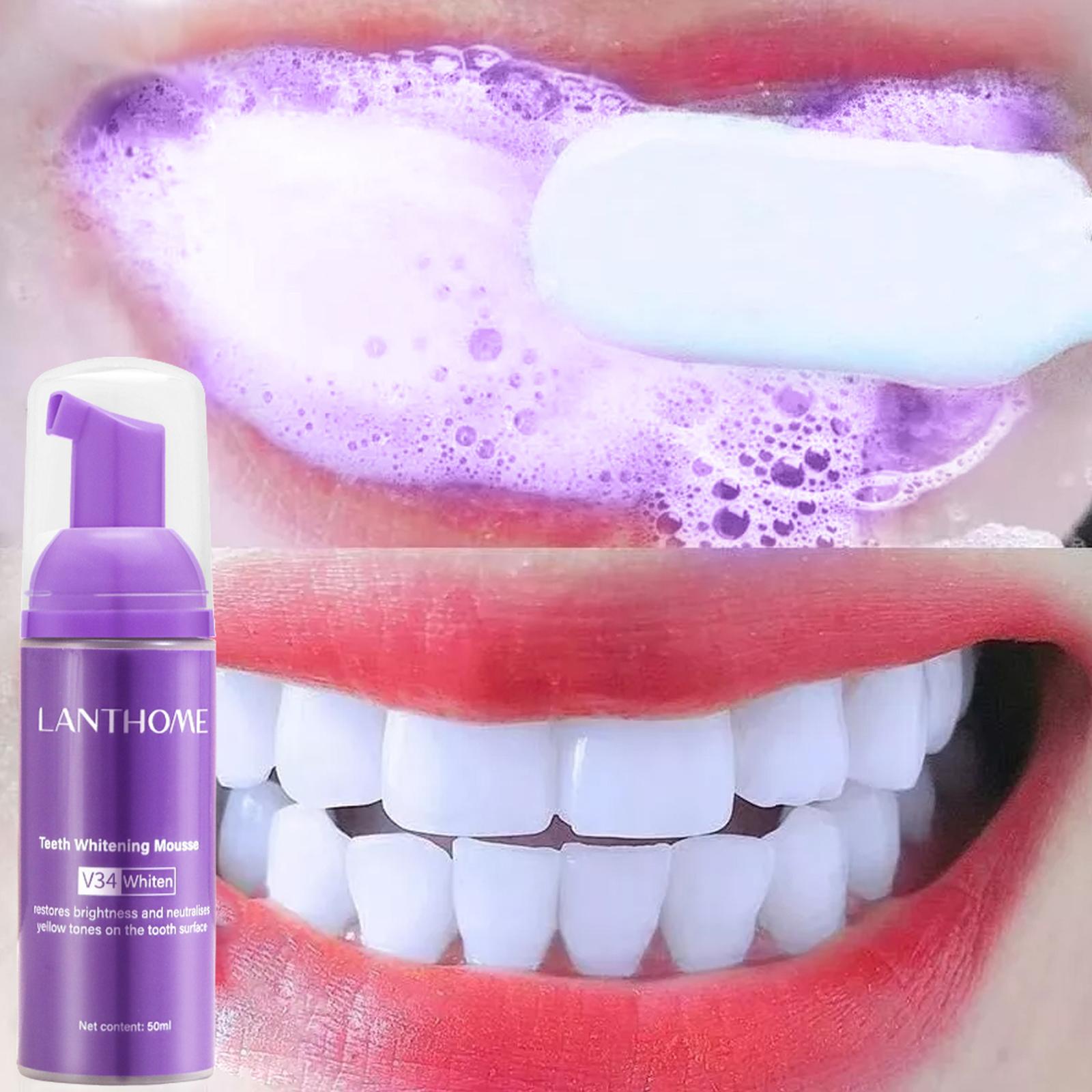 Teeth Whitening Crest - V34 Mousse Zahnreinigungs-Zahnpasta, wirksame aufhellende Zahnentfernung,