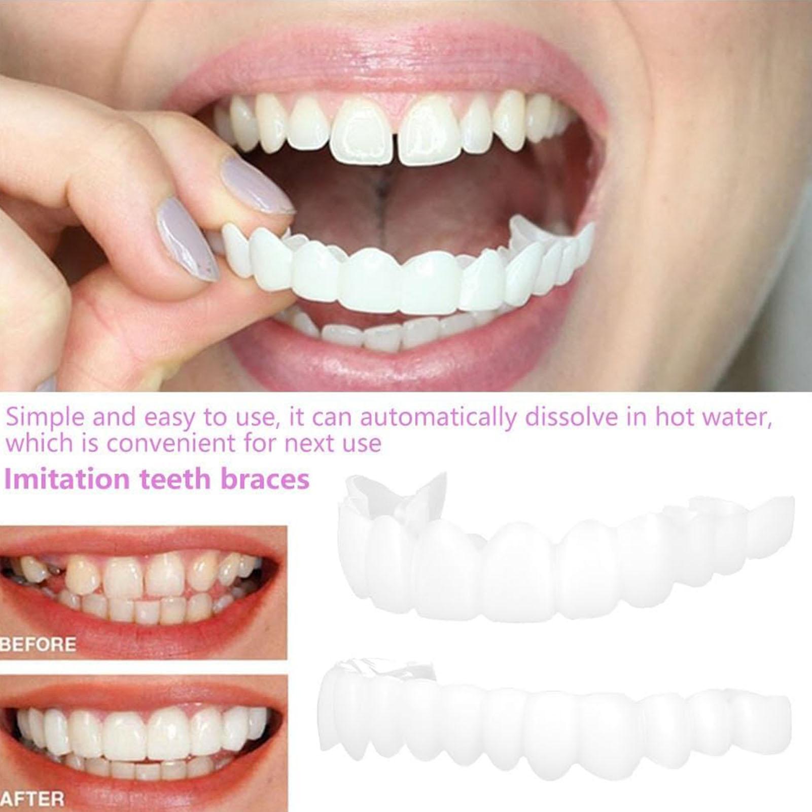 Teeth Whitening Mask - 2 stücke Männer Frauen Temporäre Zähne