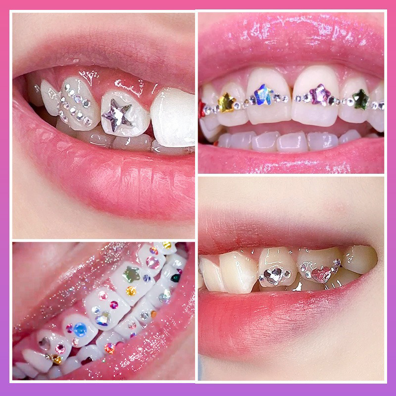 NEUES Professionelles Zahnschm – Tooth Gem Kit Bewertung und Preis