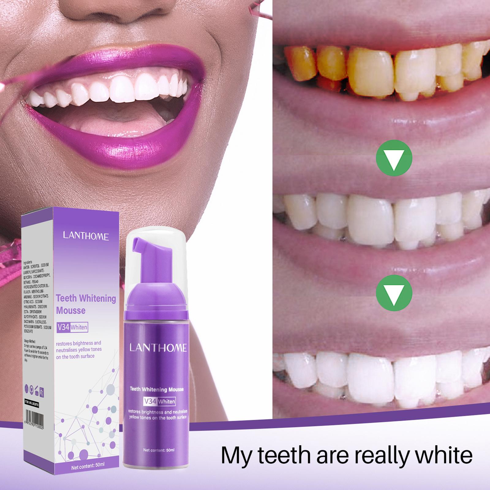 V34 Mousse Zahnreinigungs-Zahn – Teeth Whitening Crest Bewertung und Preis