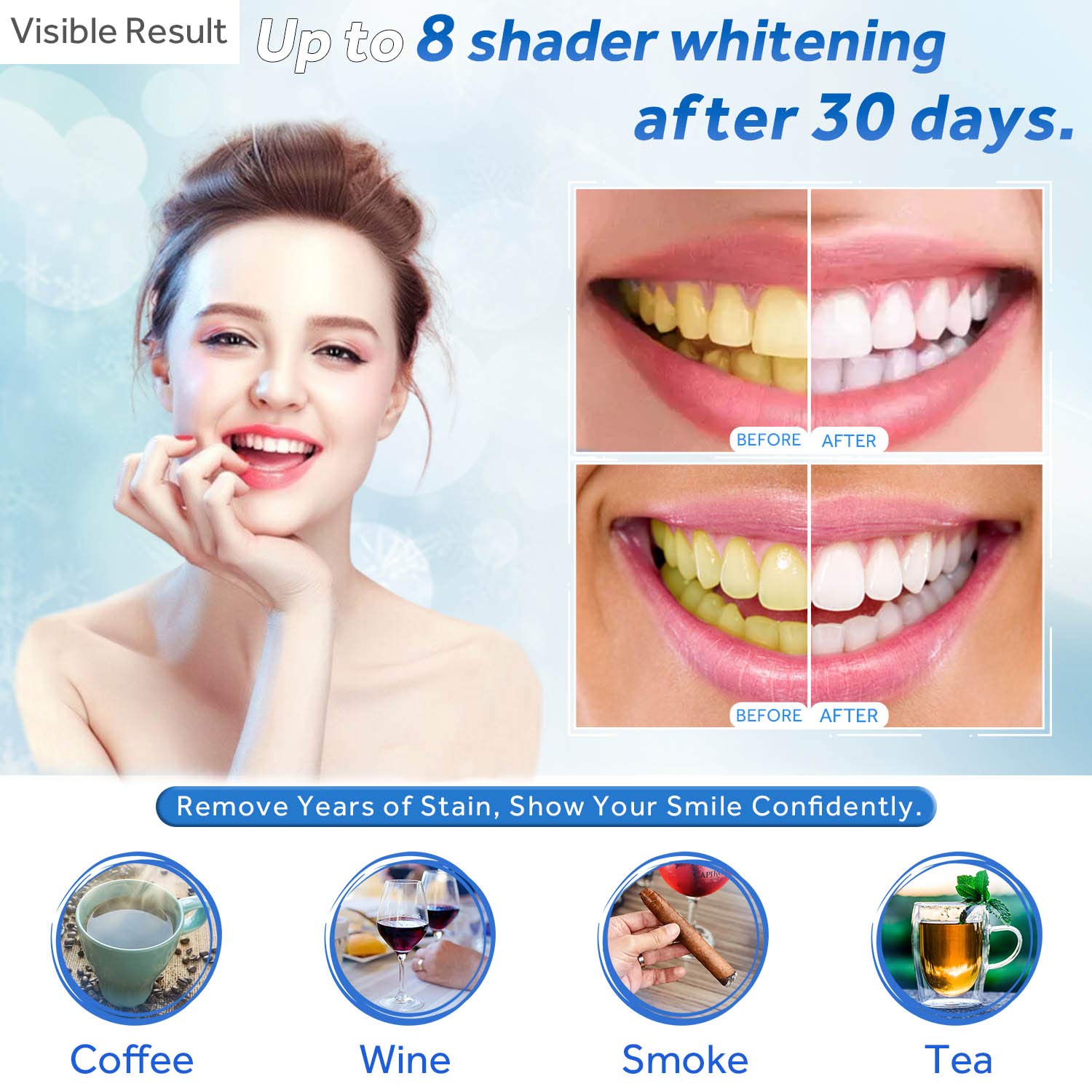 Zahnaufhellungsgel, Nachfüllsp – Teeth Whitening Mask Bewertung und Preis