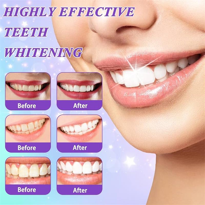 9D Lila Zahnaufhellungs-Zahnpa – Teeth Whitening Treatment Bewertung und Preis