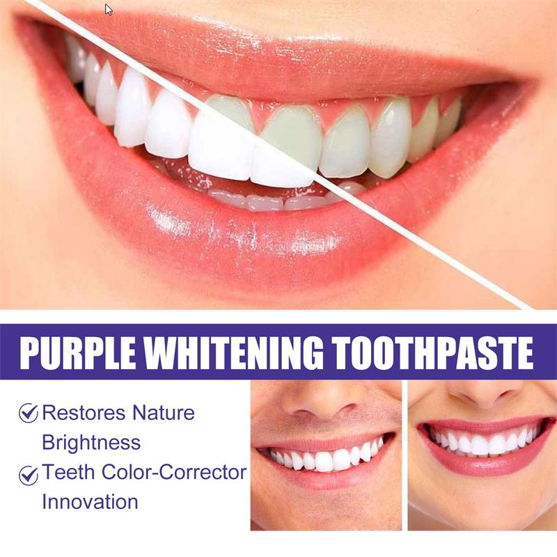 9D Lila Zahnaufhellungs-Zahnpa – Teeth Whitening Treatment Bewertung und Preis