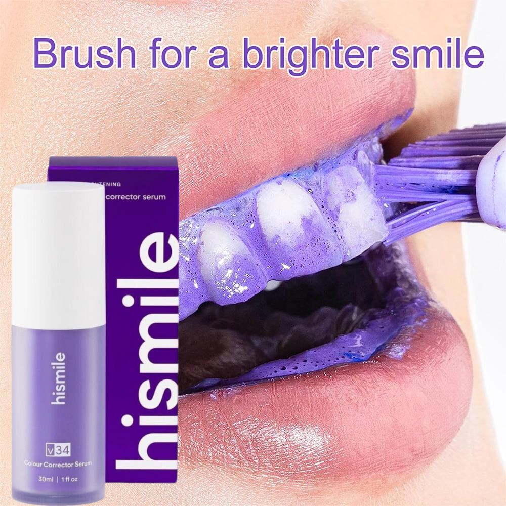 Hismile V34 Lila Zahnaufhellun – Teeth Whitening Crest Bewertung und Preis