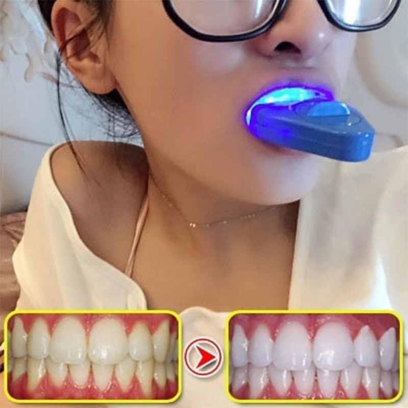 LED-Zahnaufhellungslicht, Aufh – Teeth Whitening Uv Kit Bewertung und Preis