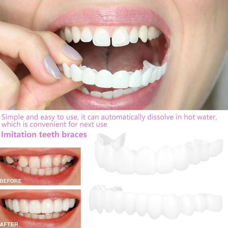 Snap On Teeth Veneers Instant  – Teeth Whitening Mask Bewertung und Preis
