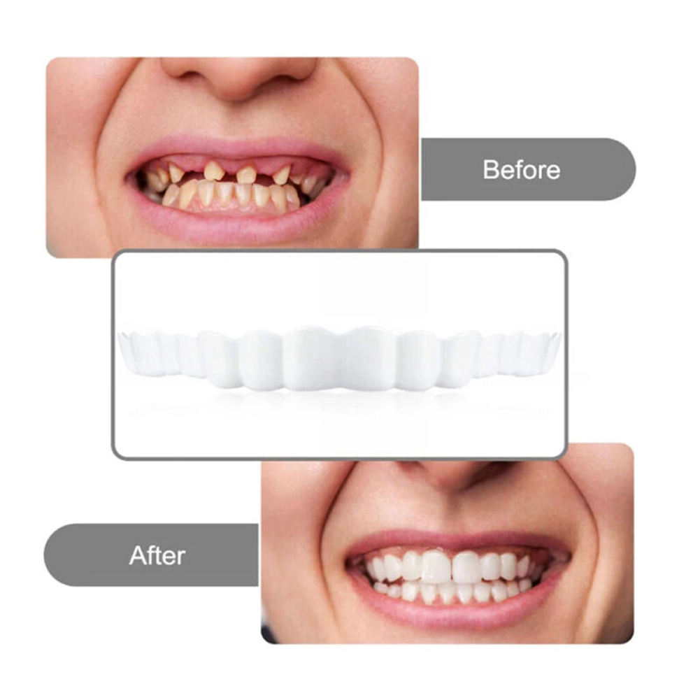 4–6 Paar Prothesen mit oberen  – Teeth Whitening Mask Bewertung und Preis