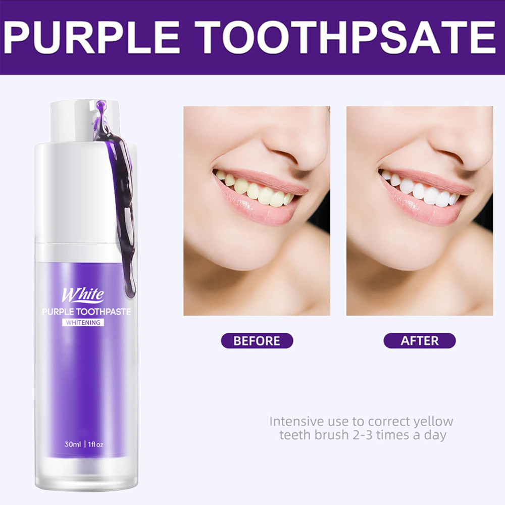 Lila Zahnaufhellungs-Zahnpasta – Teeth Whitening Treatment Bewertung und Preis