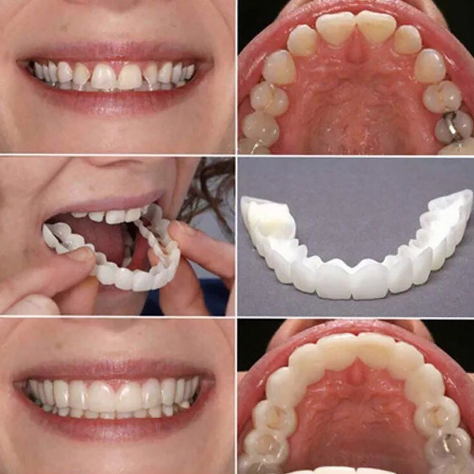 Heiße Zahnverblendungen: Zahna – Teeth Whitening Mask Bewertung und Preis