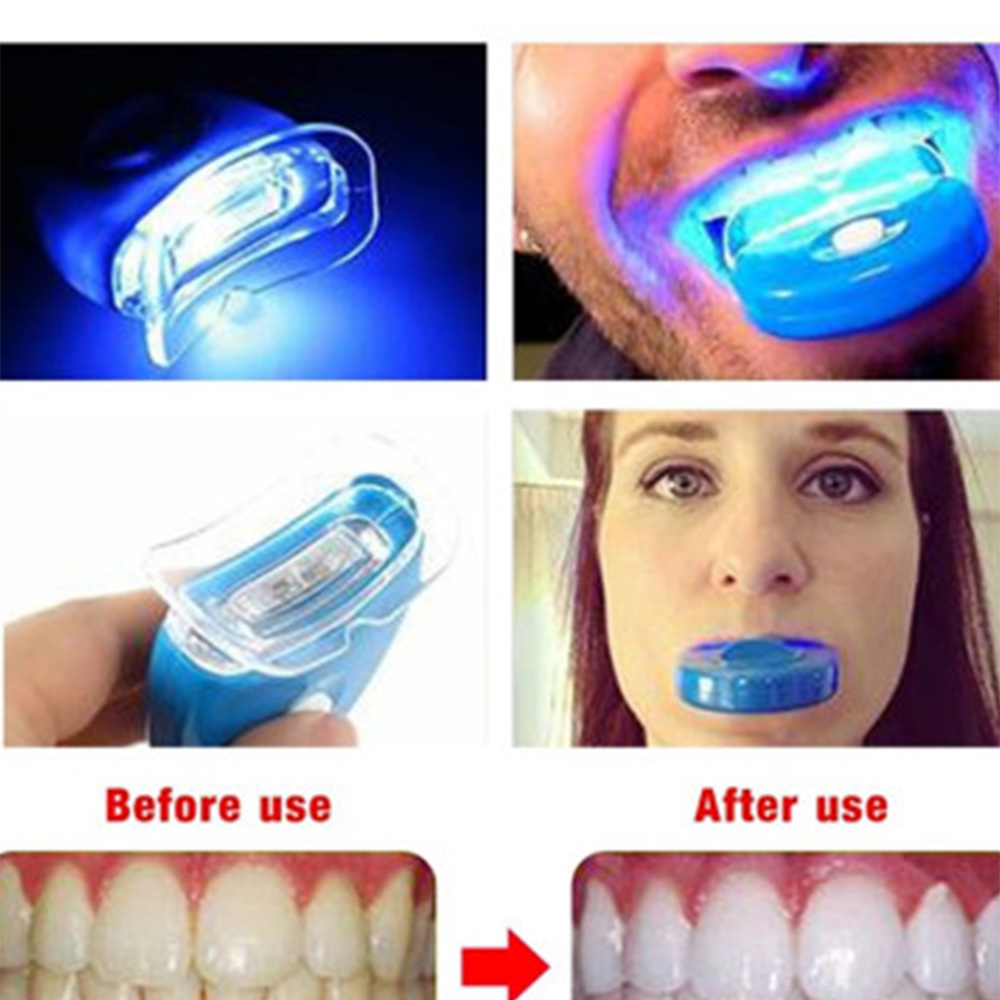 Neue Blaue Led Zähne Bleaching – Teeth Whitening Uv Kit Bewertung und Preis