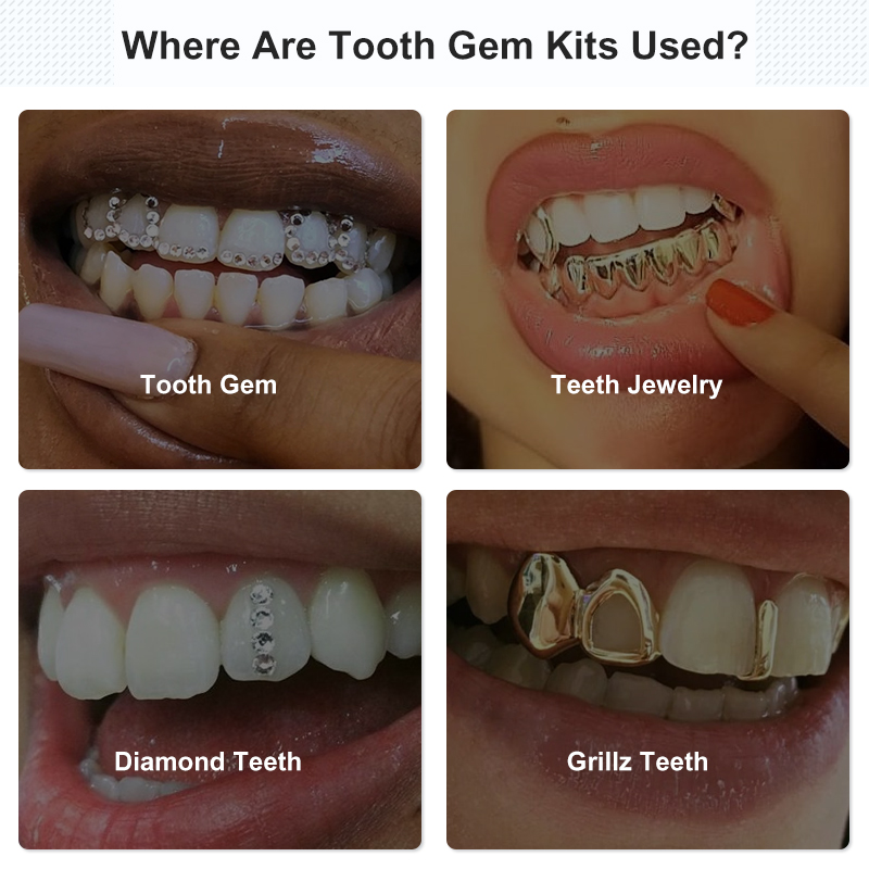 Zahn-Edelstein-Set, Kleber-Set – Tooth Gem Kit Bewertung und Preis