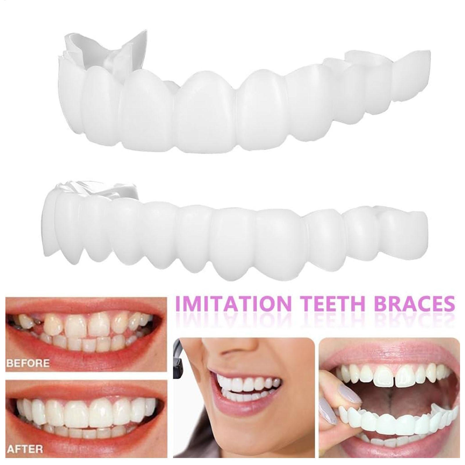 2 stücke Männer Frauen Temporä – Teeth Whitening Mask Bewertung und Preis