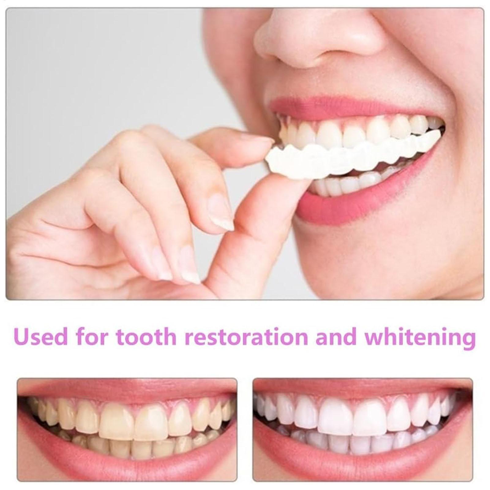 2 stücke Männer Frauen Temporä – Teeth Whitening Mask Bewertung und Preis