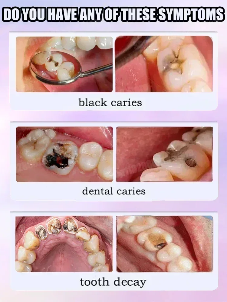 Zahnreinigungs-Zahnpasta entfe – Teeth Whitening Treatment Bewertung und Preis