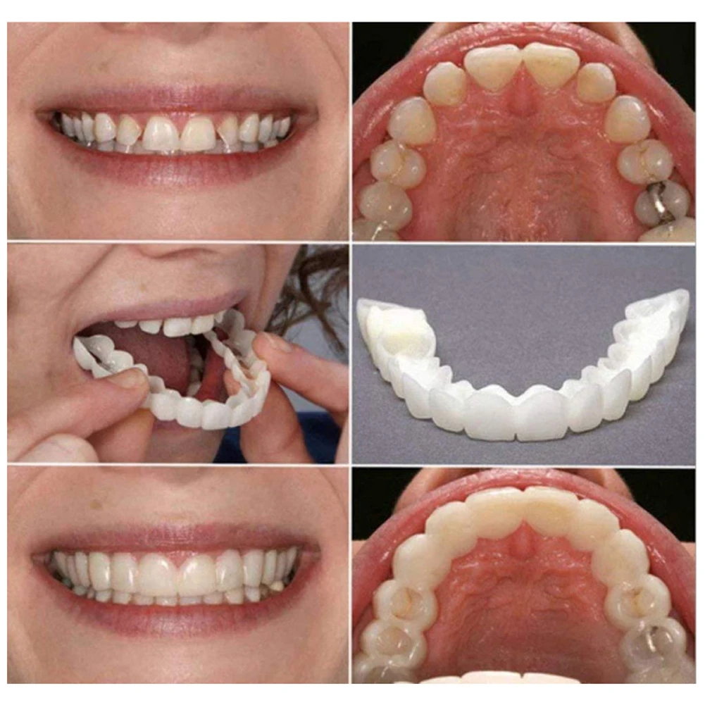 2 Paar Zahnersatz Zähne Prothe – Teeth Whitening Mask Bewertung und Preis